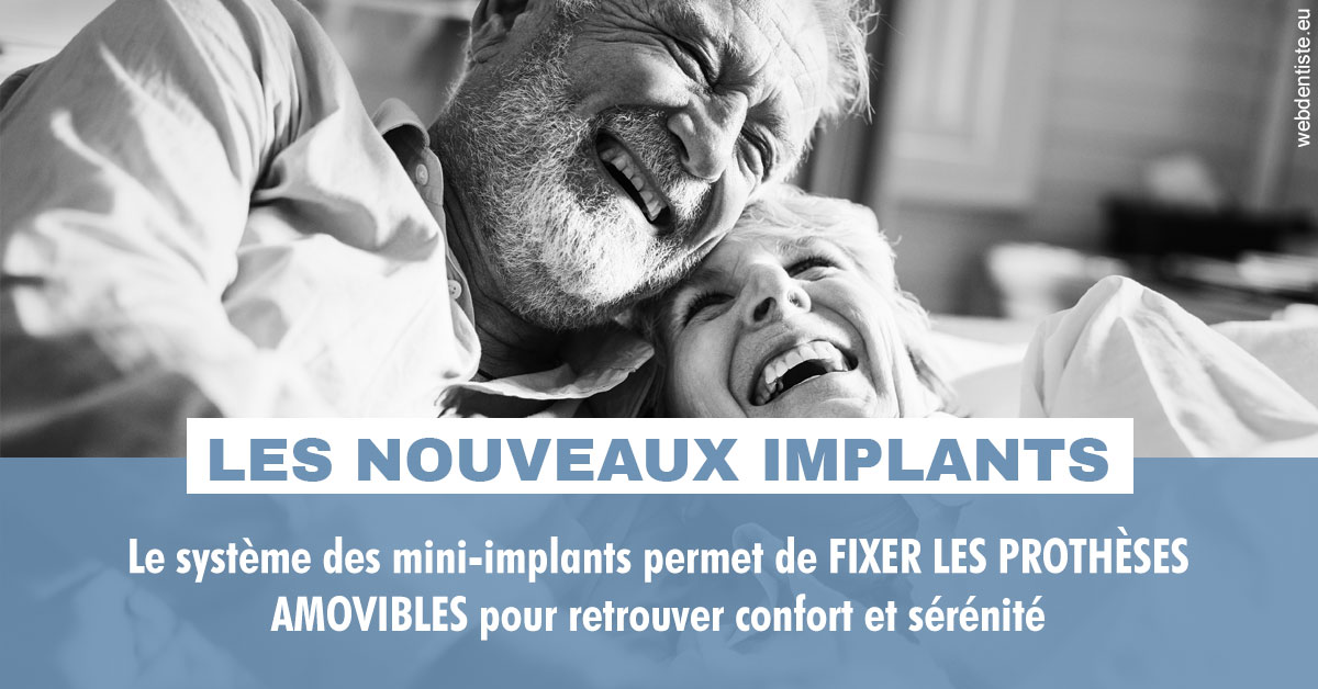 https://dr-alexandre-fevre.chirurgiens-dentistes.fr/Les nouveaux implants 2