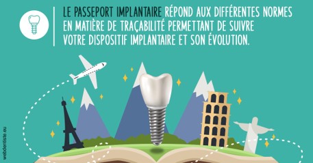 https://dr-alexandre-fevre.chirurgiens-dentistes.fr/Le passeport implantaire
