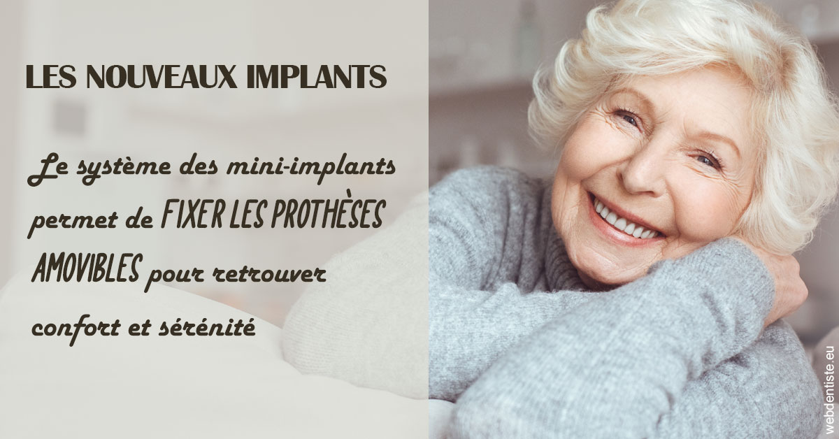 https://dr-alexandre-fevre.chirurgiens-dentistes.fr/Les nouveaux implants 1