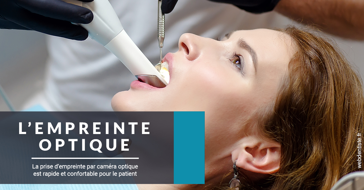 https://dr-alexandre-fevre.chirurgiens-dentistes.fr/L'empreinte Optique 1