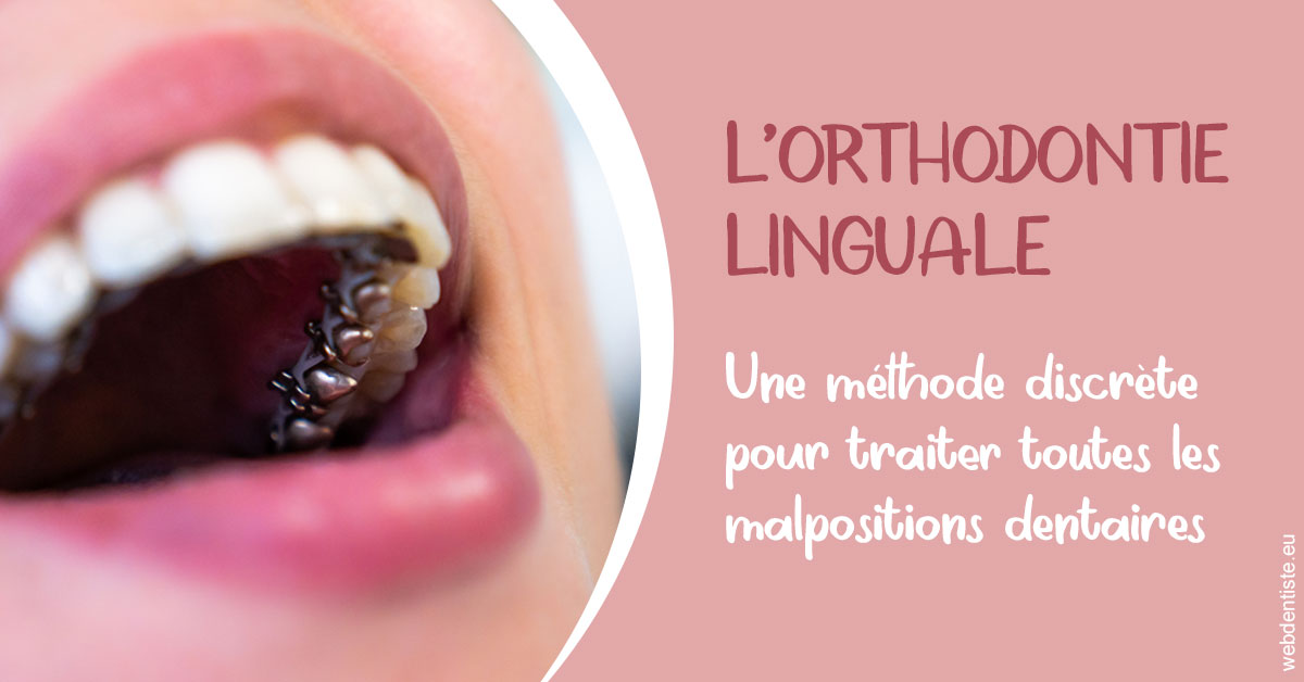 https://dr-alexandre-fevre.chirurgiens-dentistes.fr/L'orthodontie linguale 2