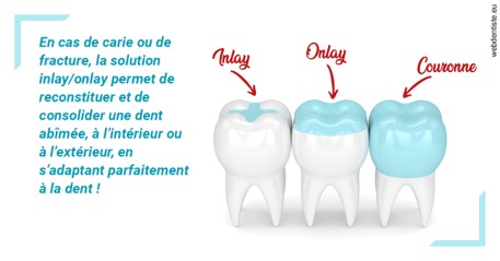 https://dr-alexandre-fevre.chirurgiens-dentistes.fr/L'INLAY ou l'ONLAY