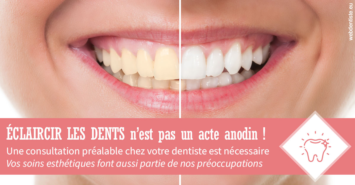 https://dr-alexandre-fevre.chirurgiens-dentistes.fr/Eclaircir les dents 1