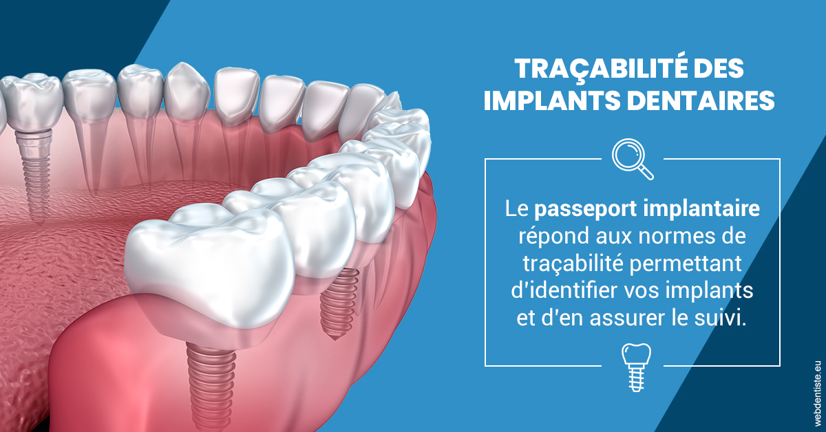 https://dr-alexandre-fevre.chirurgiens-dentistes.fr/T2 2023 - Traçabilité des implants 1