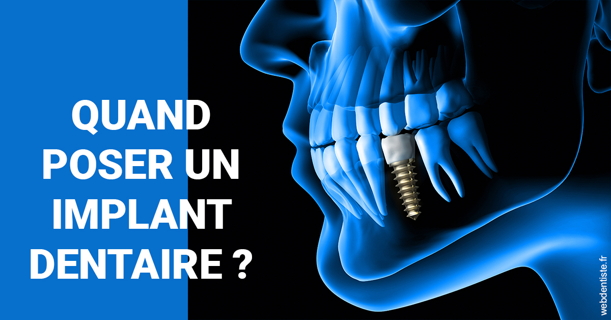 https://dr-alexandre-fevre.chirurgiens-dentistes.fr/Les implants 1