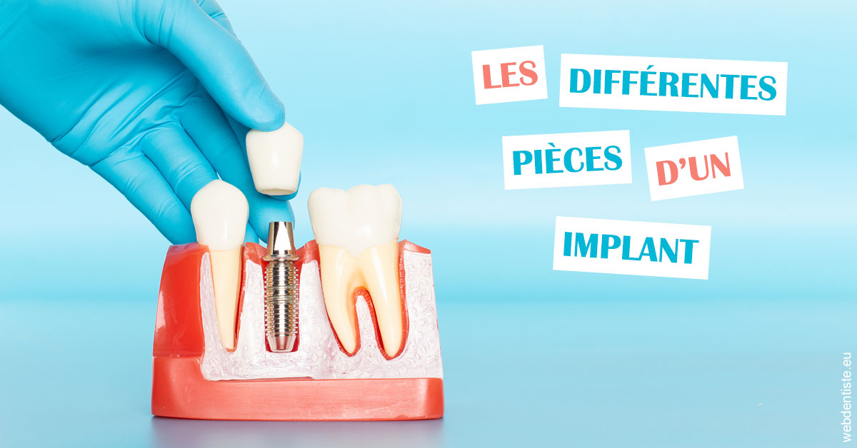 https://dr-alexandre-fevre.chirurgiens-dentistes.fr/Les différentes pièces d’un implant 2