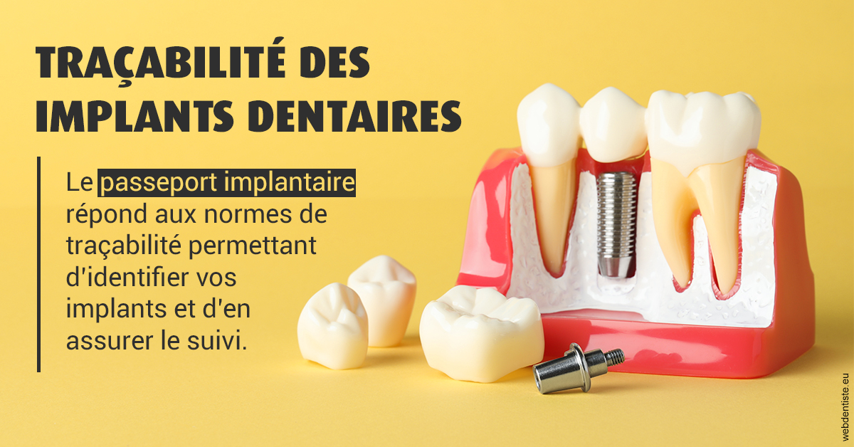 https://dr-alexandre-fevre.chirurgiens-dentistes.fr/T2 2023 - Traçabilité des implants 2