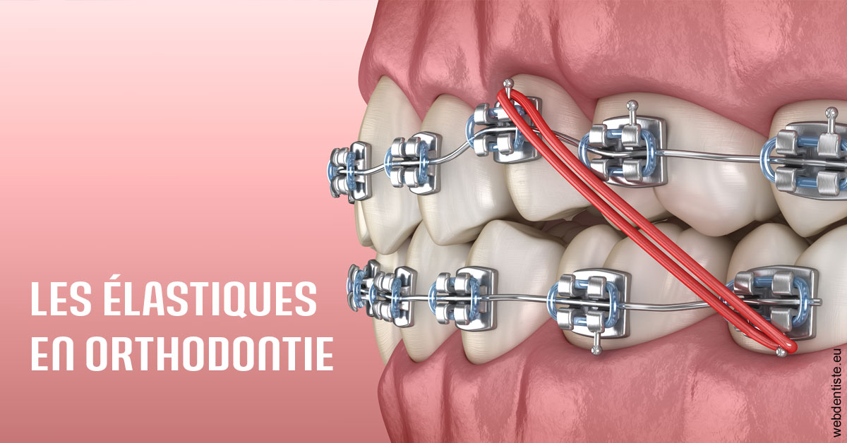 https://dr-alexandre-fevre.chirurgiens-dentistes.fr/Elastiques orthodontie 2
