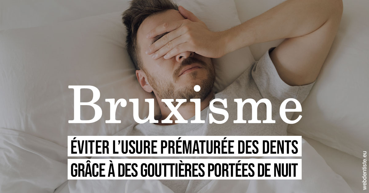 https://dr-alexandre-fevre.chirurgiens-dentistes.fr/Bruxisme 1